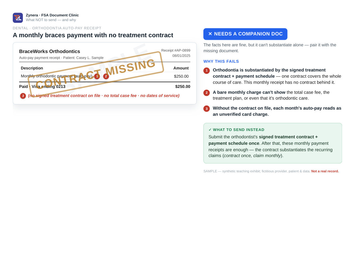 A monthly braces payment with no treatment contract